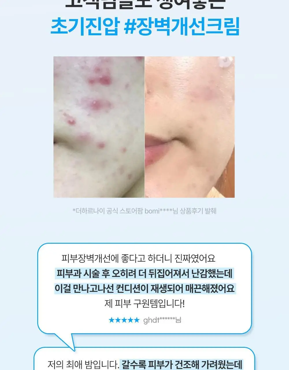 [피부장벽강화크림] 더하르나이 시카이드 밤 100ml기획(+앰플5ml*3p+크림5ml*2p) 상세페이지 13